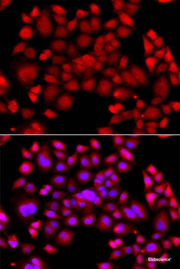 Immunofluorescence analysis of C6 cells using P Glycoprotein Polyclonal Antibody at dilution of  1:100. Blue: DAPI for nuclear staining.