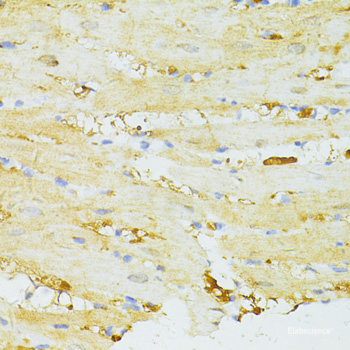 Immunohistochemistry of paraffin-embedded Human prostate using LIF Polyclonal Antibody at dilution of  1:100 (40x lens).