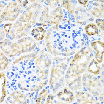 Immunohistochemistry of paraffin-embedded Rat brain using IFNL3 Polyclonal Antibody at dilution of  1:100 (40x lens).