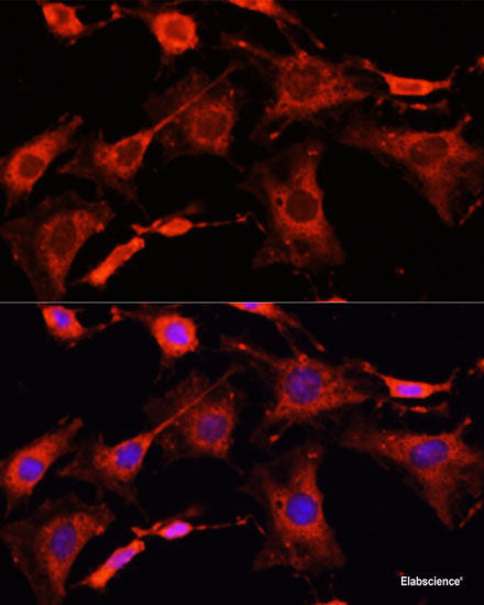 Immunohistochemistry of paraffin-embedded Rat testis using DNAJB11 Polyclonal Antibody at dilution of  1:100 (40x lens).