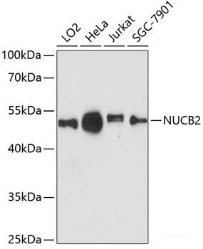 Western blot analysis of extracts of various cell lines using TAL1 Polyclonal Antibody at dilution of 1:3000.