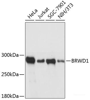 Immunohistochemistry of paraffin-embedded Human stomach using VAPA Polyclonal Antibody at dilution of  1:100 (40x lens).