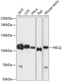 Immunohistochemistry of paraffin-embedded Human liver using CDK7 Polyclonal Antibody at dilution of  1:150 (40x lens).