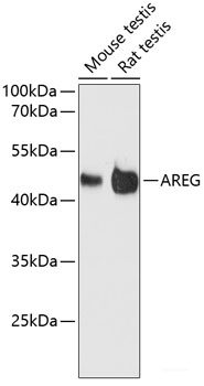 Immunohistochemistry of paraffin-embedded Human tonsil using ECH1 Polyclonal Antibody at dilution of  1:150 (40x lens).