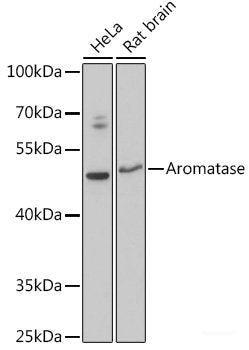 Immunofluorescence analysis of U-2 OS cells using HSD17B8 Polyclonal Antibody at dilution of  1:100 (40x lens). Blue: DAPI for nuclear staining.