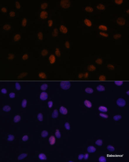 Immunohistochemistry of paraffin-embedded Human tonsil using ZMYM3 Polyclonal Antibody at dilution of  1:100 (40x lens).