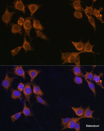 Immunofluorescence analysis of L929 cells using TNFRSF11A Polyclonal Antibody at dilution of  1:100 (40x lens). Blue: DAPI for nuclear staining.