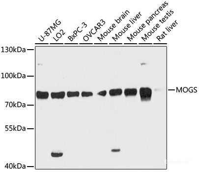 Western blot analysis of extracts of K561 cells using CD40L Polyclonal Antibody at dilution of 1:1000.