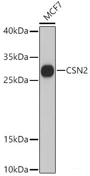 Immunohistochemistry of paraffin-embedded Human lung cancer using EP300 Polyclonal Antibody at dilution of  1:100 (40x lens).