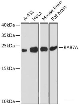 Immunohistochemistry of paraffin-embedded Mouse retina using SAG Polyclonal Antibody at dilution of  1:200 (40x lens).