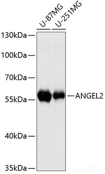 Western blot analysis of extracts of various cell lines using IFT88 Polyclonal Antibody at dilution of 1:3000.