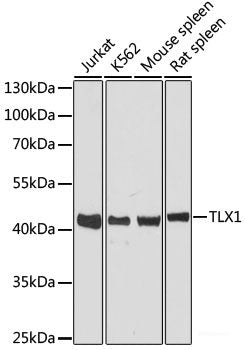 Western blot analysis of extracts of various cell lines using VPS29 Polyclonal Antibody at dilution of 1:3000.