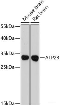 Immunohistochemistry of paraffin-embedded Rat retina using ANO2 Polyclonal Antibody at dilution of  1:200 (40x lens).