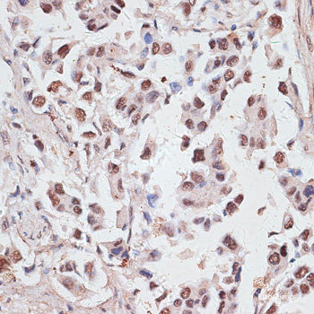 Immunofluorescence analysis of C6 cells using SCGB3A2 Polyclonal Antibody at dilution of  1:100. Blue: DAPI for nuclear staining.