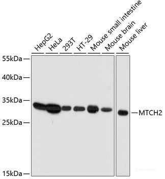 Immunohistochemistry of paraffin-embedded Rat pancreas using ZNF581 Polyclonal Antibody at dilution of  1:100 (40x lens).