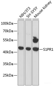 Immunohistochemistry of paraffin-embedded Human lung cancer using U2AF1 Polyclonal Antibody at dilution of  1:100 (40x lens).