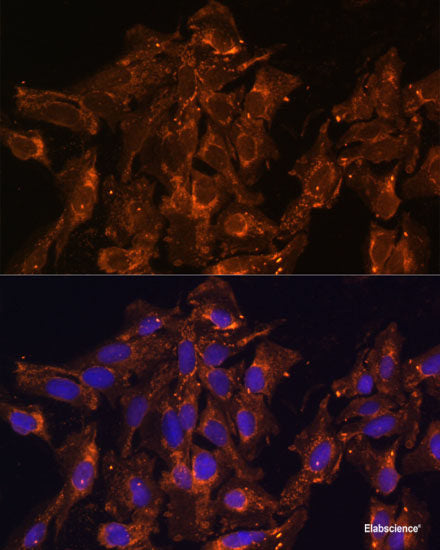 Immunohistochemistry of paraffin-embedded Human lung cancer using OTP Polyclonal Antibody at dilution of  1:100 (40x lens).