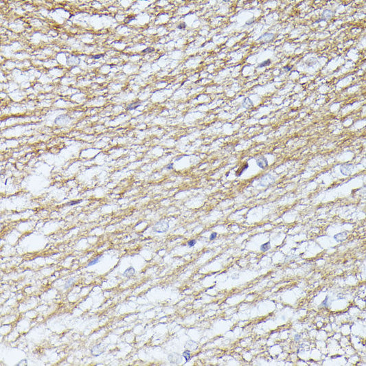 Western blot analysis of extracts of various cell lines using CRISPLD2 Polyclonal Antibody at dilution of 1:3000.