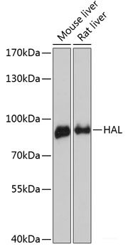 Immunofluorescence analysis of NIH/3T3 cells using CHAT Polyclonal Antibody at dilution of  1:100. Blue: DAPI for nuclear staining.