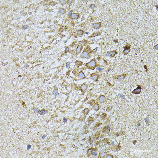 Immunohistochemistry of paraffin-embedded Rat brain using TBCB Polyclonal Antibody at dilution of  1:100 (40x lens).