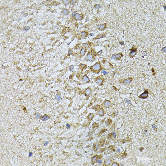 Immunohistochemistry of paraffin-embedded Rat brain using TBCB Polyclonal Antibody at dilution of  1:100 (40x lens).