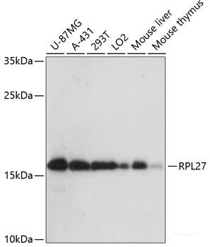 Immunohistochemistry of paraffin-embedded Human colon using HHLA2 Polyclonal Antibody at dilution of  1:100 (40x lens).