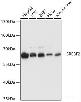 Immunohistochemistry of paraffin-embedded Rat liver using CTCF Polyclonal Antibody at dilution of  1:200 (40x lens).