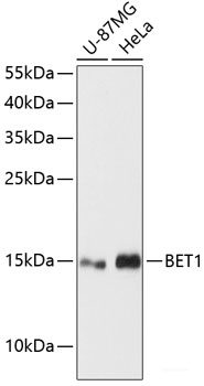 Immunofluorescence analysis of HeLa cells using CHRNA1 Polyclonal Antibody