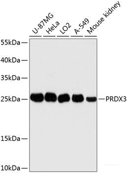 Immunohistochemistry of paraffin-embedded Rat lung using DDX5 Polyclonal Antibody at dilution of  1:100 (40x lens).