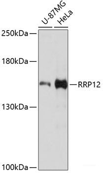Immunohistochemistry of paraffin-embedded Human liver damage using DLST Polyclonal Antibody at dilution of  1:100 (40x lens).