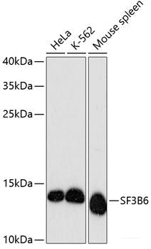 Immunohistochemistry of paraffin-embedded Rat ovary using HLA-DPB1 Polyclonal Antibody at dilution of  1:100 (40x lens).