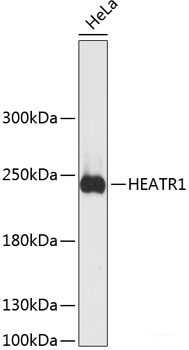 Immunohistochemistry of paraffin-embedded Rat kidney using IL12RB1 Polyclonal Antibody at dilution of  1:200 (40x lens).
