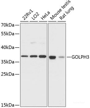 Immunohistochemistry of paraffin-embedded Rat spleen using PCNA Polyclonal Antibody at dilution of  1:100 (40x lens).