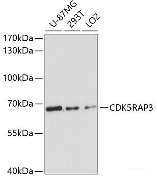 Immunohistochemistry of paraffin-embedded Rat brain using PRKAB2 Polyclonal Antibody at dilution of  1:100 (40x lens).
