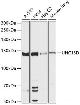 Immunohistochemistry of paraffin-embedded Human gastric cancer using SARS Polyclonal Antibody at dilution of  1:100 (40x lens).