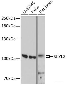 Immunohistochemistry of paraffin-embedded Human colon cancer using MBTPS1 Polyclonal Antibody at dilution of  1:100 (40x lens).