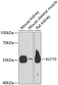 Immunofluorescence analysis of A549 cells using SNX3 Polyclonal Antibody