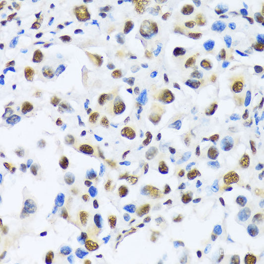 Immunofluorescence analysis of HeLa cells using RIPK2 Polyclonal Antibody