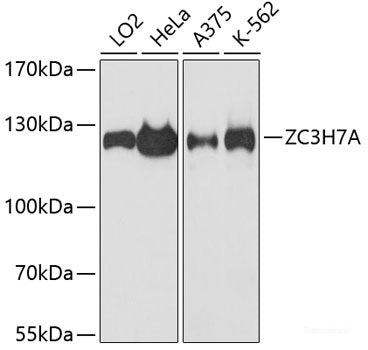 Immunohistochemistry of paraffin-embedded Mouse brain using TNFRSF11A Polyclonal Antibody at dilution of  1:100 (20x lens).