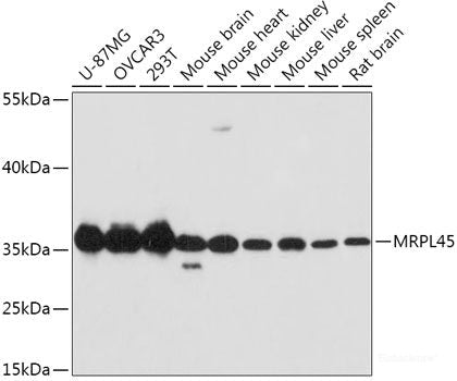 Immunohistochemistry of paraffin-embedded Human liver cancer using NFS1 Polyclonal Antibody at dilution of  1:100 (40x lens).