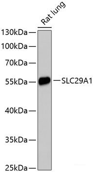 Immunohistochemistry of paraffin-embedded Human liver damage using DPP3 Polyclonal Antibody at dilution of  1:100 (40x lens).