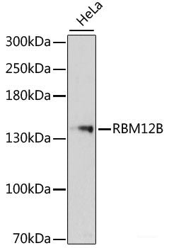 Immunohistochemistry of paraffin-embedded Rat brain using ZNF346 Polyclonal Antibody at dilution of  1:100 (40x lens).