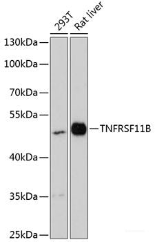 Immunohistochemistry of paraffin-embedded Rat brain using PELP1 Polyclonal Antibody at dilution of  1:100 (40x lens).
