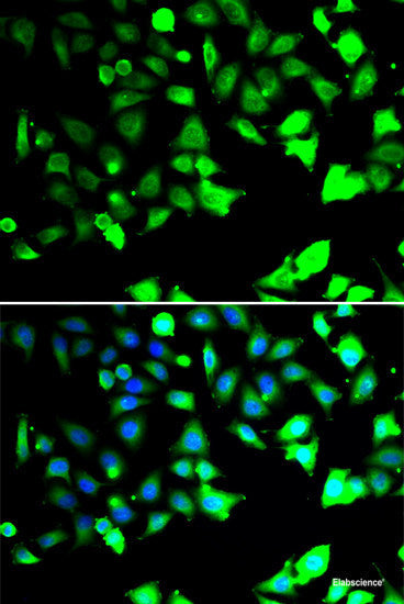 Western blot analysis of extracts of various cell lines using Cytochrome c Polyclonal Antibody at dilution of 1:1000.