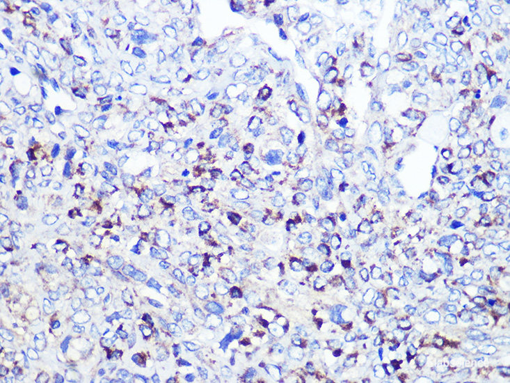 Immunohistochemistry of paraffin-embedded Human kidney using GOPC Polyclonal Antibody at dilution of  1:100 (40x lens).