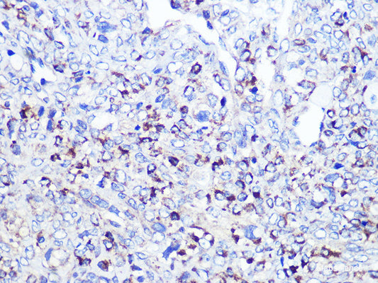 Immunohistochemistry of paraffin-embedded Human kidney using GOPC Polyclonal Antibody at dilution of  1:100 (40x lens).