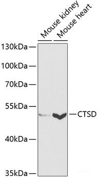 Immunofluorescence analysis of Hela cells using TIM-3/HAVCR2 Polyclonal Antibody at dilution of  1:100 (40x lens). Blue: DAPI for nuclear staining.