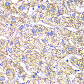 Immunohistochemistry of paraffin-embedded Human colon carcinoma using TET3 Polyclonal Antibody at dilution of  1:200 (40x lens).