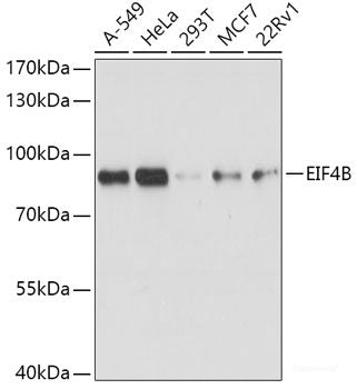 Immunohistochemistry of paraffin-embedded Human prostate using ACPP Polyclonal Antibody at dilution of  1:100 (40x lens).