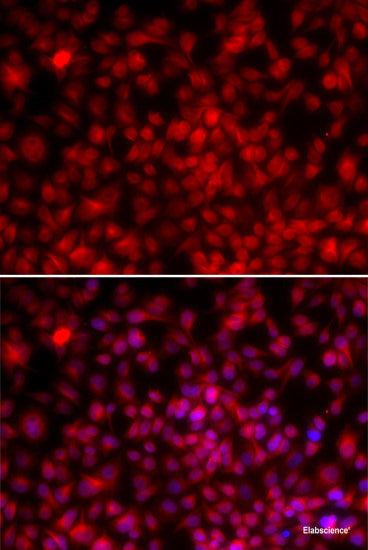 Immunofluorescence analysis of U-2 OS cells using ATF3 Polyclonal Antibody at dilution of  1:100. Blue: DAPI for nuclear staining.